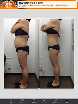 健康痩身研究所 蟹江店/ビフォーアフター