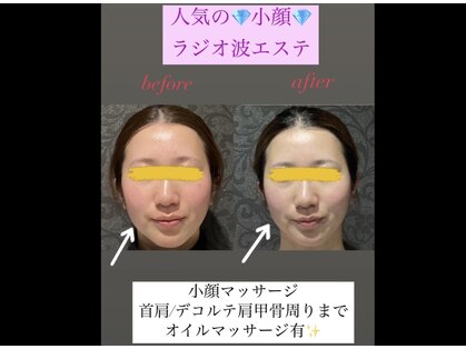 リボーン(REBORN)の写真