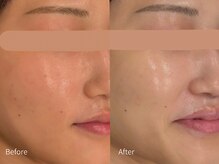 アウラ 小杉店(AULA)/ララピール☆