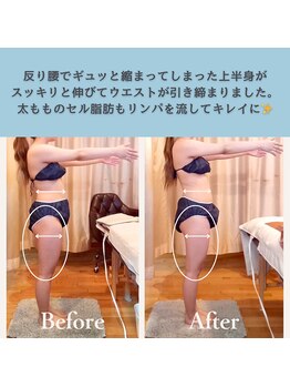 エルバード/反り腰解消で美ライン！