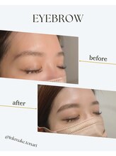 トナリ(tonari)/女性／HBL