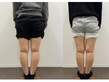 なおちゃん整骨院 整体院/O脚モニター様4回目後ろから