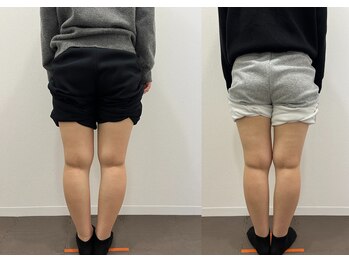 なおちゃん整骨院 整体院/O脚モニター様4回目後ろから