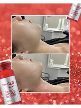 エステルーム クリスタル/渡韓せずに叶う！輪郭形成