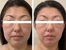 ドクターボディクリスタル(Dr.Body Crystal)の雰囲気（カウンセリングにて丁寧に原因を診断いたします）
