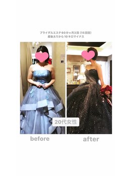 トランキーロ(Tranquilo)/体型が変わって諦めている方へ