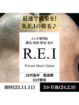 レイ(R.E.I)/ひげ脱毛／20代後半／ひげ濃い目