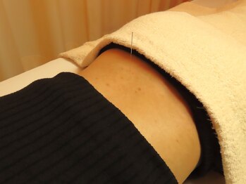 中医鍼灸治療センター/