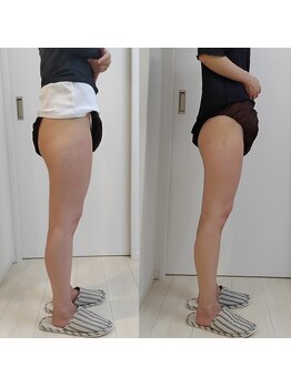 ユニクリア(Uni clear)/痩身エステ