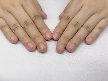 ヒューマン鍼灸接骨院/爪整体:深爪