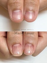 マリーロール 天王寺店(Marie Laure)/深爪改善/自爪育成/ネイルケア