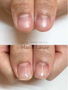 マリーロール 天王寺店(Marie Laure)/深爪改善/自爪育成/ネイルケア