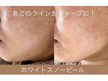 シャルール(Chaleur)の雰囲気(【ホワイトスノーピール】変化を実感したい方におすすめです!)