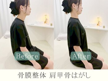 ヒラメント 亀戸院(Hilament)/肩甲骨ビフォーアフター〈整体〉