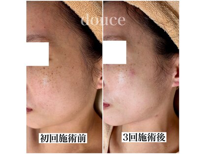 ドゥース(douce)の写真