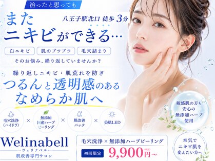 ウェリナベル(WelinaBelle)の写真