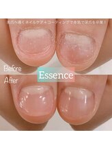 エッセンス (Essence)/ディープケア＋補強コーティング