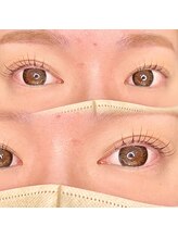 エメ(Aimer)/メーテルロッド