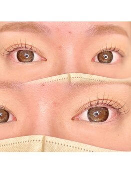 エメ(Aimer)/メーテルロッド