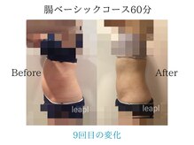 リープル(Leapl)/【腸もみ】腸もみ後の変化写真