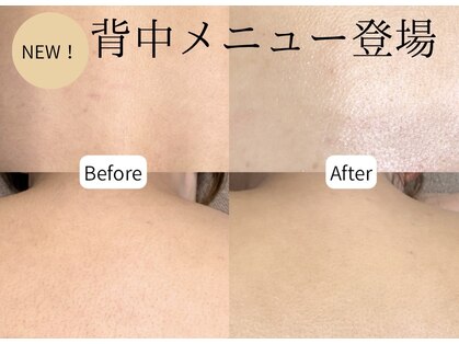 エヌクレアール(Ncrear)の写真