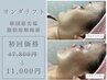 【小顔No.1】全顔ボリュームダウンマイクロリフト 8月限定11000円