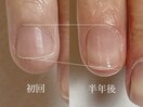【フィルイン】自爪育成