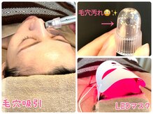 サロン アグランシュ(salon A.glansh)/ざらつき毛穴お掃除☆毛穴吸引☆