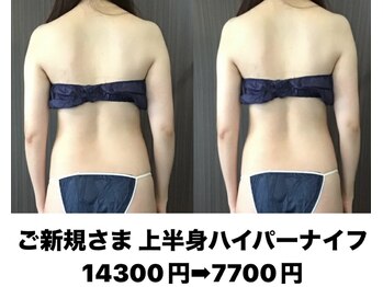 バーテックスキー(Vertexkey)