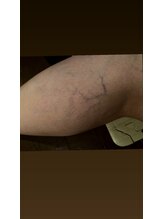 ヌッカ 学芸大学店(Nucca)/