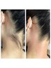 【清潔感溢れる！うなじへ♪】うなじWAX＋光脱毛　ライスWAX使用