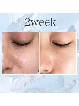 プリマプリート 可児店/スキンケアを変えるだけで？