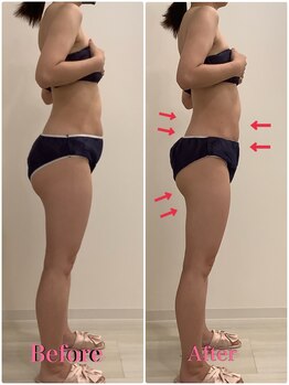 スペチアーレ 夙川/脂肪撃退