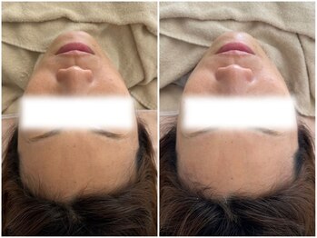 マヴィ 高槻店(MavY.)/スノーピーリング