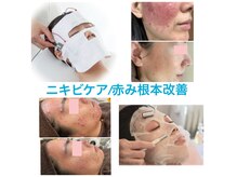 ビエル(Bielle)