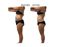 ヨサパーク サノン(YOSA PARK Sanon)/ よもぎ蒸し/痩身/リンパ