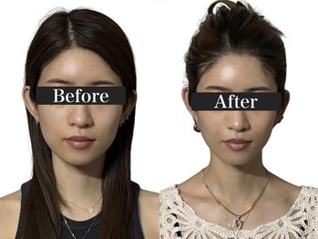 オアシス トウキョウ 心斎橋(OASIS TOKYO)/