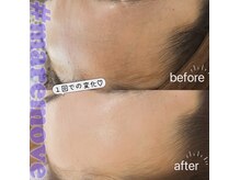 eyesalon SHELLFAの雰囲気（【くすみ改善！】憧れのつるぴか肌◇マリムーブ美顔WAX）