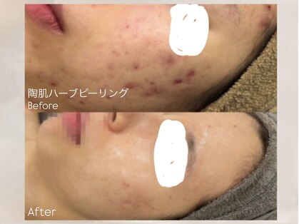 ルミナ(Lumina)の写真