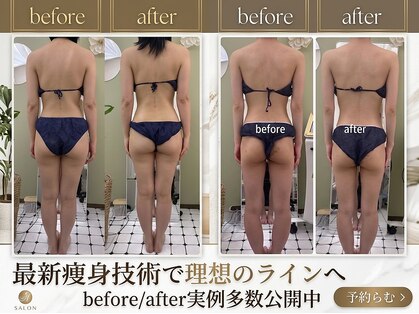 グランルリエ(Gran Rurier)の写真