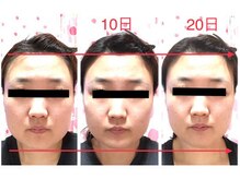 スイープジュニパー 東浦(sweep juniper)/自宅で集中ケア