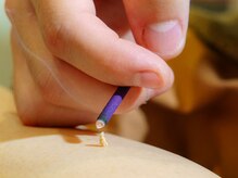 ヨカアンベ(YOKAanbe)/女性特有のお悩み、逆子も対応◎