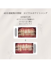 プラスビーセルフ(+b self)/ホワイトニングビフォーアフター