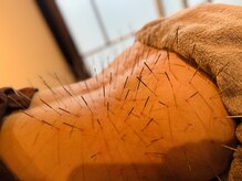 あらゆる事をしても改善しなかった腰痛にも