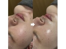 お一人お一人のお悩みに合わせて丁寧な施術を心がけています。