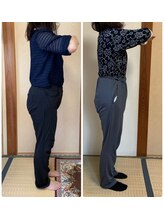 リンドール(RinDoll)/60代女性ダイエット/耳ツボ/痩身