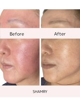 シャムリー(SHAMRY)/SEN管理／ホームケア