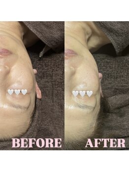 エルミオ エスパシオ ミロク(El mio espacio 369miroku)/CARBOXY FACIAL★