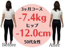 アシストユー整体院/下半身太りとむくみ解消！