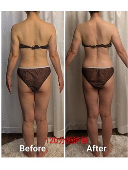 フィニシオン/50代 　120分施術